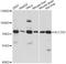 Solute Carrier Family 7 Member 2 antibody, A14574, ABclonal Technology, Western Blot image 