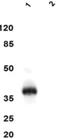 C-X-C Motif Chemokine Ligand 16 antibody, NBP2-50187, Novus Biologicals, Western Blot image 