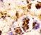 RAB7A, Member RAS Oncogene Family antibody, LS-C175838, Lifespan Biosciences, Immunohistochemistry paraffin image 