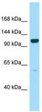 PPFIA Binding Protein 2 antibody, TA334352, Origene, Western Blot image 