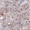 Zinc Finger Protein 691 antibody, HPA062527, Atlas Antibodies, Immunohistochemistry paraffin image 