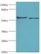 Carnosine Dipeptidase 1 antibody, LS-C378373, Lifespan Biosciences, Western Blot image 