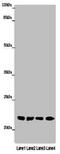 Abhydrolase Domain Containing 14B antibody, CSB-PA842687LA01HU, Cusabio, Western Blot image 