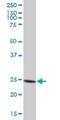 Proteasome 20S alpha 6 antibody, H00005687-B01P, Novus Biologicals, Western Blot image 