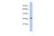 Fibroblast Growth Factor 13 antibody, PA5-44342, Invitrogen Antibodies, Western Blot image 