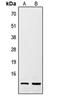 Resistin antibody, LS-C353870, Lifespan Biosciences, Western Blot image 