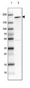 Nuclear Receptor Coactivator 3 antibody, NBP1-90256, Novus Biologicals, Western Blot image 