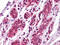 EPH Receptor A7 antibody, M03943, Boster Biological Technology, Immunohistochemistry paraffin image 