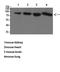 Transforming Growth Factor Beta Receptor 3 antibody, STJ98586, St John