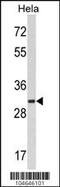 Myristoylated Alanine Rich Protein Kinase C Substrate antibody, 61-411, ProSci, Western Blot image 