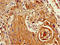 SET Domain Containing 5 antibody, LS-C398443, Lifespan Biosciences, Immunohistochemistry paraffin image 