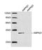 Protein Kinase AMP-Activated Non-Catalytic Subunit Beta 1 antibody, LS-B14130, Lifespan Biosciences, Western Blot image 