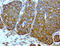 PYM Homolog 1, Exon Junction Complex Associated Factor antibody, LS-C796966, Lifespan Biosciences, Immunohistochemistry paraffin image 