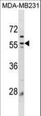 Perilipin 3 antibody, LS-B11795, Lifespan Biosciences, Western Blot image 