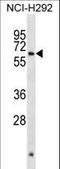 Aristaless Related Homeobox antibody, LS-C156526, Lifespan Biosciences, Western Blot image 