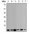 Vesicle Associated Membrane Protein 3 antibody, abx141984, Abbexa, Western Blot image 