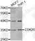 Cyclin Dependent Kinase 20 antibody, A2686, ABclonal Technology, Western Blot image 