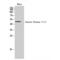 Casein Kinase 1 Gamma 2 antibody, LS-C382437, Lifespan Biosciences, Western Blot image 