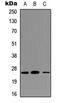 Triggering Receptor Expressed On Myeloid Cells 1 antibody, MBS8219498, MyBioSource, Western Blot image 