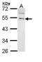 Gastrin Releasing Peptide Receptor antibody, GTX108176, GeneTex, Western Blot image 