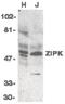 Death Associated Protein Kinase 3 antibody, PA5-19902, Invitrogen Antibodies, Western Blot image 