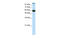 General Transcription Factor IIIC Subunit 5 antibody, 28-371, ProSci, Western Blot image 