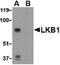 Serine/Threonine Kinase 11 antibody, PA5-20325, Invitrogen Antibodies, Western Blot image 