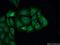 Neurofilament Light antibody, 12998-1-AP, Proteintech Group, Immunofluorescence image 