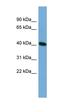 Testis Specific Serine Kinase 2 antibody, orb325903, Biorbyt, Western Blot image 