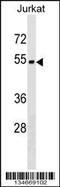Zinc Finger Protein 703 antibody, 59-818, ProSci, Western Blot image 