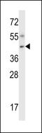 NIM1 Serine/Threonine Protein Kinase antibody, LS-C164503, Lifespan Biosciences, Western Blot image 