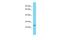 Zinc Finger AN1-Type Containing 2B antibody, A12678, Boster Biological Technology, Western Blot image 