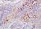 Matrix Metallopeptidase 1 antibody, orb101432, Biorbyt, Immunohistochemistry paraffin image 