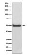 Calcium/Calmodulin Dependent Protein Kinase II Delta antibody, M02611, Boster Biological Technology, Western Blot image 