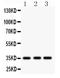 BP2 antibody, PB9605, Boster Biological Technology, Western Blot image 