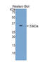 Solute Carrier Family 17 Member 5 antibody, LS-C294027, Lifespan Biosciences, Western Blot image 