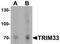 Tripartite Motif Containing 33 antibody, TA319933, Origene, Western Blot image 