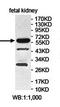 Zinc Finger Protein 266 antibody, orb78383, Biorbyt, Western Blot image 