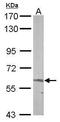 5'-Aminolevulinate Synthase 2 antibody, PA5-21553, Invitrogen Antibodies, Western Blot image 