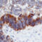 Protein Tyrosine Kinase 7 (Inactive) antibody, MAB4499, R&D Systems, Immunohistochemistry paraffin image 