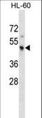 Potassium Voltage-Gated Channel Subfamily J Member 3 antibody, LS-C165433, Lifespan Biosciences, Western Blot image 