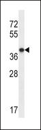 Purinergic Receptor P2Y1 antibody, LS-C163318, Lifespan Biosciences, Western Blot image 