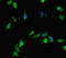 Centromere Protein A antibody, LS-C677498, Lifespan Biosciences, Immunofluorescence image 