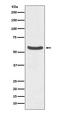 Solute Carrier Family 2 Member 2 antibody, M02297, Boster Biological Technology, Western Blot image 