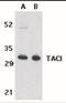 TNF Receptor Superfamily Member 13B antibody, NBP1-76779, Novus Biologicals, Western Blot image 