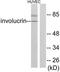 P48998 antibody, TA314106, Origene, Western Blot image 