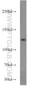 Trafficking Protein Particle Complex 9 antibody, 16014-1-AP, Proteintech Group, Western Blot image 