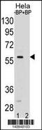 SMAD Family Member 5 antibody, 60-724, ProSci, Western Blot image 