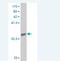 Collagen Type XXIV Alpha 1 Chain antibody, H00255631-M07, Novus Biologicals, Western Blot image 