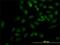 Kinesin-like protein KIF2C antibody, H00011004-M01, Novus Biologicals, Immunofluorescence image 